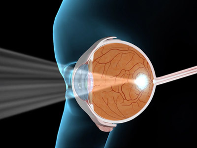 Emory Vision Eye Cross Section